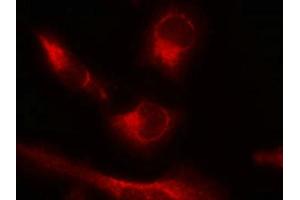Immunofluorescence staining of methanol-fixed Hela cells using Tau(Phospho-Ser356) Antibody. (MAPT 抗体  (pSer356))
