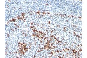 Image no. 2 for Mouse anti-Human kappa Light Chain antibody (ABIN6174183) (小鼠 anti-人 kappa Light Chain Antibody)
