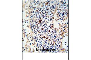 Kappa light chain Antibody (ABIN1539833 and ABIN2843812) immunohistochemistry analysis in formalin fixed and paraffin embedded human lymph tissue followed by peroxidase conjμgation of the secondary antibody and DAB staining. (kappa Light Chain 抗体)