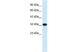 ZBTB32 antibody used at 0. (ZBTB32 抗体  (N-Term))