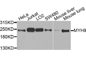 Western blot analysis of extracts of various cells, using MYH9 antibody. (Myosin 9 抗体)