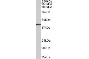 ABIN5539536 (0. (HMBS 抗体  (AA 160-173))