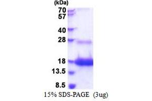 SDS-PAGE (SDS) image for Lymphocyte Antigen 6 Complex, Locus D (LY6D) (AA 21-98) protein (His tag) (ABIN5853487)