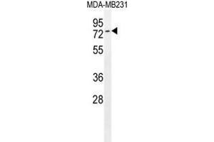 Tiparp Antibody (C-term) western blot analysis in MDA-MB231 cell line lysates (35 µg/lane). (Tiparp 抗体  (C-Term))