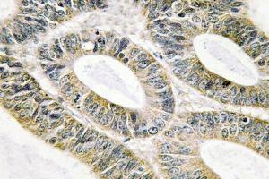 Immunohistochemistry analysis of Galectin-9 antibody . (Galectin 9 抗体)