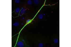 Indirect immunostaining of PFA fixed rat hippocampus neurons with anti-synaptoporin (1 : 500; red) and mouse anti-MAP 2 (cat. (Synaptoporin 抗体)