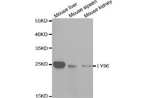Western blot analysis of extracts of various cell lines, using LY96 antibody (ABIN5970959) at 1/1000 dilution. (LY96 抗体)