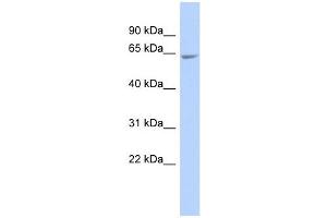 GALNTL4 antibody used at 1 ug/ml to detect target protein. (UDP-N-Acetyl-alpha-D-Galactosamine:polypeptide N-Acetylgalactosaminyltransferase 18 (GALNT18) (Middle Region) 抗体)