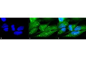Immunocytochemistry/Immunofluorescence analysis using Rabbit Anti-p38 Polyclonal Antibody (ABIN361847 and ABIN361848). (MAPK14 抗体)