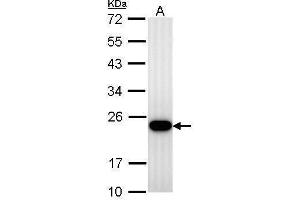 WB Image Transgelin antibody detects TAGLN protein by Western blot analysis. (Transgelin 抗体)