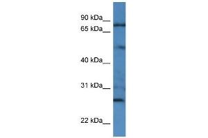 Human HCT15; WB Suggested Anti-GOLGA1 Antibody Titration: 0. (GOLGA1 抗体  (Middle Region, N-Term))
