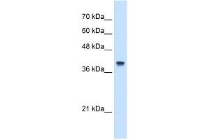 WB Suggested Anti-IFI44L Antibody Titration:  5. (IFI44L 抗体  (N-Term))