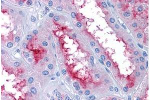Human Kidney: Formalin-Fixed, Paraffin-Embedded (FFPE) (GCC2 抗体  (AA 1174-1185))