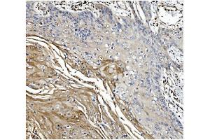 IHC analysis of GSDMD using anti-GSDMD antibody (ABIN7599433).