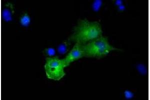 Anti-DYNC1LI1 mouse monoclonal antibody (ABIN2452966) immunofluorescent staining of COS7 cells transiently transfected by pCMV6-ENTRY DYNC1LI1 (RC222010). (DYNC1LI1 抗体)