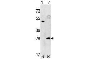 Image no. 1 for anti-Proteasome Subunit alpha 5 (PSMA5) (N-Term) antibody (ABIN356944) (PSMA5 抗体  (N-Term))