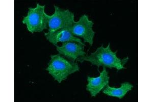 ICC/IF analysis of FABP1 in Hep3B cells line, stained with DAPI (Blue) for nucleus staining and monoclonal anti-human FABP1 antibody (1:100) with goat anti-mouse IgG-Alexa fluor 488 conjugate (Green). (FABP1 抗体  (AA 1-127))