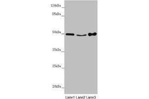 Western blot All lanes: MYLIP antibody at 4. (MYLIP 抗体  (AA 266-445))
