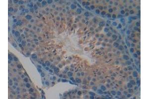 Immunohistochemistry (IHC) image for anti-Cysteine-Rich, Angiogenic Inducer, 61 (CYR61) (AA 176-379) antibody (ABIN7439291)