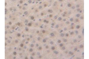 Used in DAB staining on fromalin fixed paraffin-embedded Liver tissue (GSTa5 抗体  (AA 1-221))