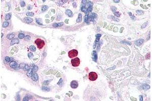 Human Neutrophils: Formalin-Fixed, Paraffin-Embedded (FFPE) (TLR4 抗体  (C-Term))
