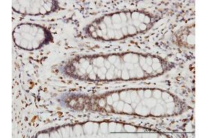 Immunoperoxidase of monoclonal antibody to WDR20 on formalin-fixed paraffin-embedded human colon. (WDR20 抗体  (AA 1-569))