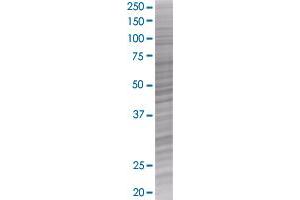 TP53 transfected lysate. (TP53 293T Cell Transient Overexpression Lysate(Denatured))