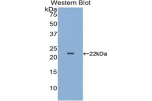 Detection of Recombinant PARK7, Human using Polyclonal Antibody to Parkinson Disease Protein 7 (PARK7) (PARK7/DJ1 抗体  (AA 1-189))