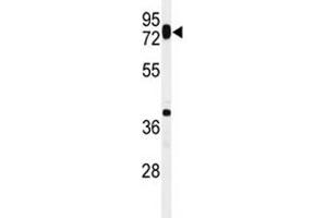 Western blot analysis of HAS1 antibody in ZR-75-1 lysate. (HAS1 抗体  (AA 166-193))