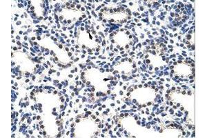 Image no. 1 for anti-Processing of Precursor 4, Ribonuclease P/MRP Subunit (POP4) (C-Term) antibody (ABIN202077)
