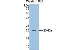 Western blot analysis of the recombinant protein. (GDF1 抗体  (AA 183-357))