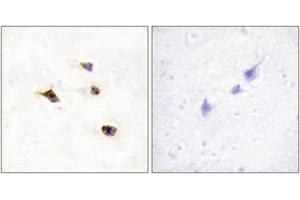 Immunohistochemistry (IHC) image for anti-Inositol Hexakisphosphate Kinase 3 (IP6K3) (AA 201-250) antibody (ABIN2889729) (IP6K3 抗体  (AA 201-250))