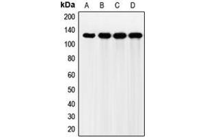 Western blot analysis of FGFR2 expression in HeLa (A), Jurkat (B), HEK293T (C), mouse liver (D) whole cell lysates. (FGFR2 抗体  (Center))
