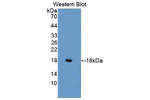 Western blot analysis of the recombinant protein. (LIFR 抗体  (AA 641-790))