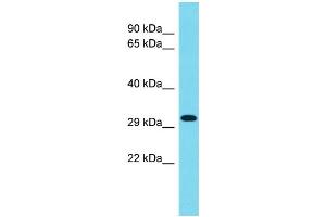 Host: Rabbit Target Name: CCDC75 Sample Type: 293T Whole Cell lysates Antibody Dilution: 1. (CCDC75 抗体  (C-Term))