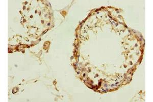 Immunohistochemistry of paraffin-embedded human testis tissue using ABIN7174232 at dilution of 1:100 (UBQLNL 抗体  (AA 305-475))