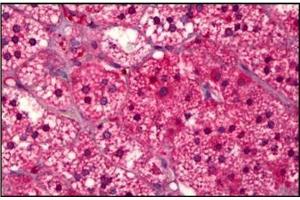 Human Adrenal Cortex: Formalin-Fixed, Paraffin-Embedded (FFPE) (SUCNR1 抗体)