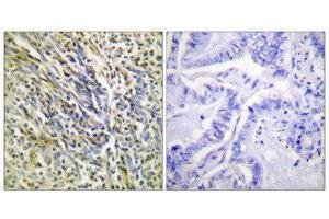 Immunohistochemistry (IHC) image for anti-Aggrecan (ACAN) (Cleaved-Asp369), (N-Term) antibody (ABIN1853445) (Aggrecan 抗体  (Cleaved-Asp369, N-Term))