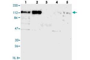 Western blot analysis of Lane 1: RT-4, Lane 2: U-251 MG, Lane 3: Human Plasma, Lane 4: Liver, Lane 5: Tonsil with CEP97 polyclonal antibody  at 1:250-1:500 dilution. (CEP97 抗体)