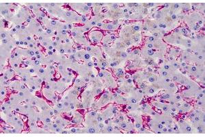 Human Liver: Formalin-Fixed, Paraffin-Embedded (FFPE) (Caveolin-1 抗体)