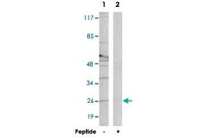 Western blot analysis of extracts from Raw 264. (CREBZF 抗体)
