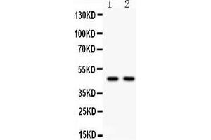 Anti- Hsp47 Picoband antibody, Western blotting All lanes: Anti Hsp47  at 0. (SERPINH1 抗体  (AA 247-418))