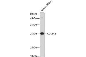 Immunofluorescence (IF) image for anti-Collagen, Type IV, alpha 3 (COL4A3) (C-Term) antibody (ABIN7266460)