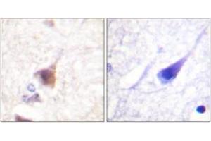 Immunohistochemistry analysis of paraffin-embedded human brain, using CaMK4 (Phospho-Thr196/200) Antibody. (CAMK4 抗体  (pThr200))