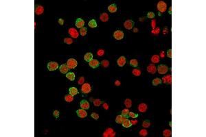 Immunofluorescence (IF) image for anti-zeta-Chain (TCR) Associated Protein Kinase 70kDa (ZAP70) (AA 1-254) antibody (ABIN6940909)