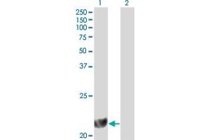 Western Blot analysis of DHFR expression in transfected 293T cell line by DHFR monoclonal antibody (M01), clone 2B10. (Dihydrofolate Reductase 抗体  (AA 88-187))