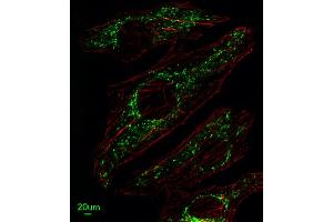 Immunofluorescence (IF) image for anti-Solute Carrier Family 25, Member 37 (SLC25A37) (AA 309-338), (C-Term) antibody (ABIN653670)