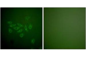 Immunofluorescence analysis of A549 cells, using FHIT Antibody. (FHIT 抗体  (AA 81-130))