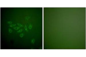 Immunofluorescence analysis of A549 cells, using FHIT Antibody. (FHIT 抗体  (AA 81-130))
