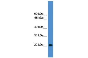WB Suggested Anti-NUDT16L1 Antibody Titration:  0. (NUDT16L1 抗体  (Middle Region))